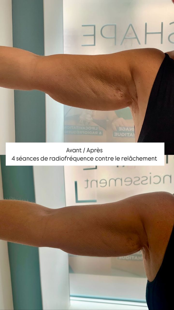 Foto 13 di DERMASHAPE
